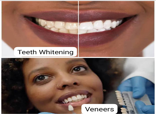 Cosmetic Dentistry